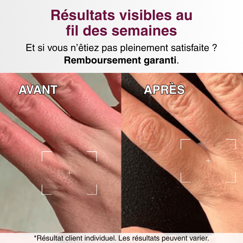 OFFRE ANNIVERSAIRE | Crème de Nuit Anti-Âge pour les Mains